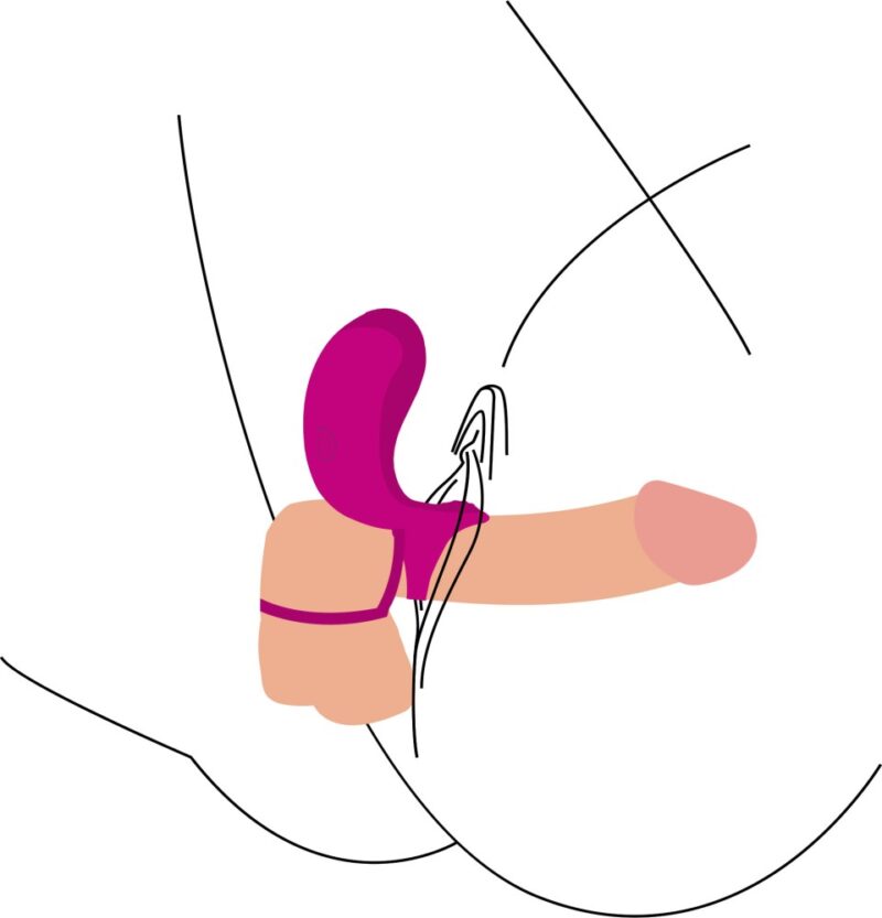 Anello Vibrante Fucsia con Telecomando Wireless